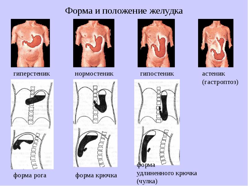 Положение желудка. Формы и положения желудка. Формы желудка в зависимости от телосложения. Положение желудка в организме человека.