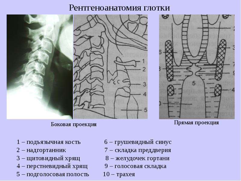 Прямая и боковая проекция