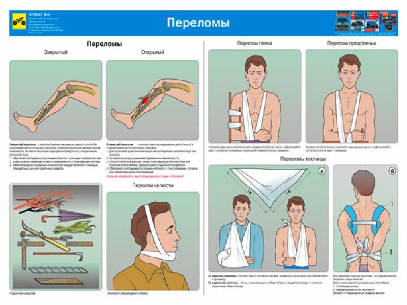 Основы медицинских знаний презентация по обж