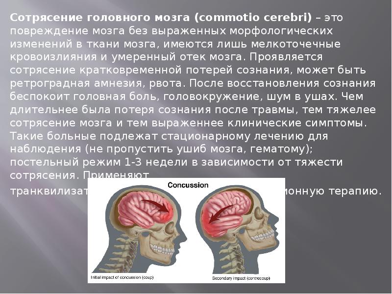 Сотрясение головного мозга презентация