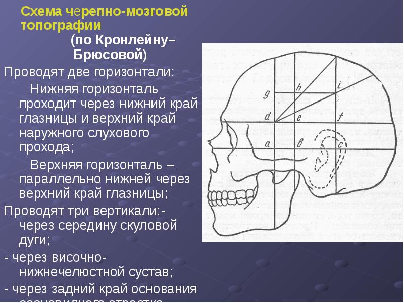 Треугольник шипо границы схема