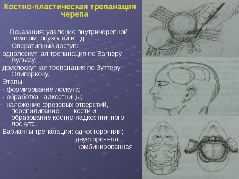 Костно пластическая трепанация черепа презентация