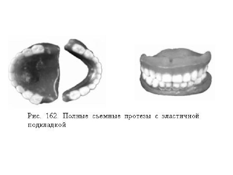 Полный съемный протез презентация