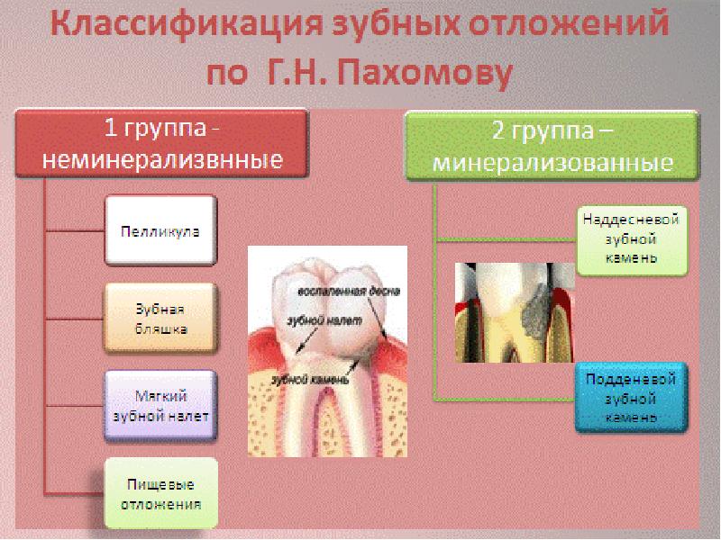 Классификация зубных. Классификация зубных отложений. Классификация назубных отложений. Зубной налет классификация. Классификация зубных отложений по Пахомову.