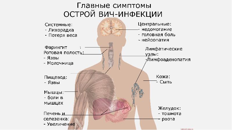 Вич симптомы у женщин в картинках