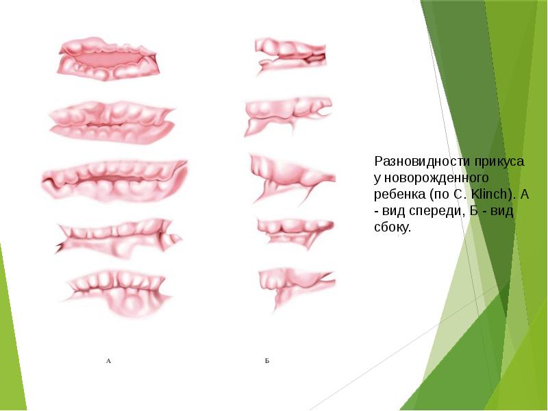 Виды прикусов презентация