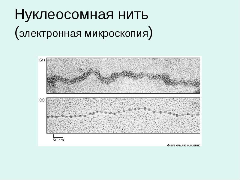 Нуклеосомная нить (электронная микроскопия)