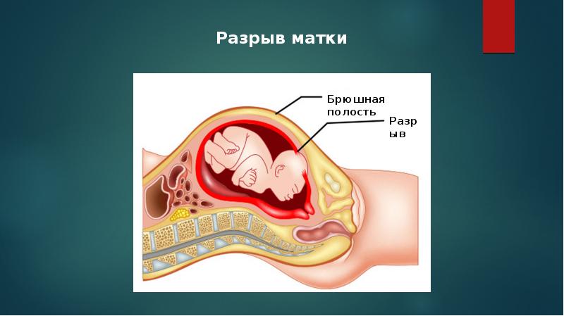 Беременность и роды 8 класс презентация