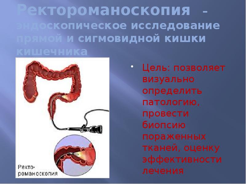 Исследование прямой кишки