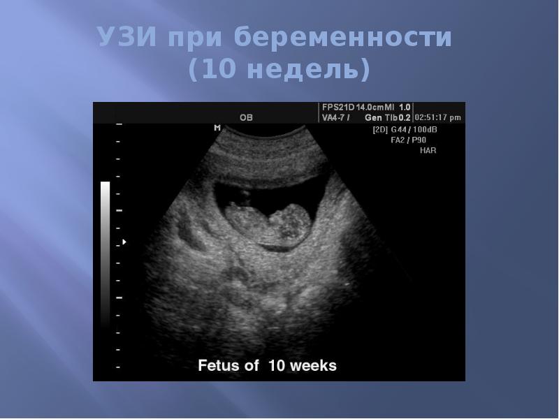 Узи Ребенка По Неделям Беременности Фото Плода