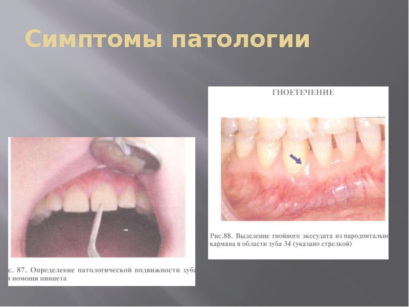 Симптомы патологии Симптомы патологии