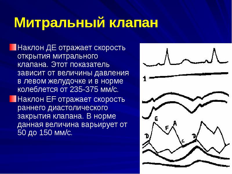 Митральный клапан это