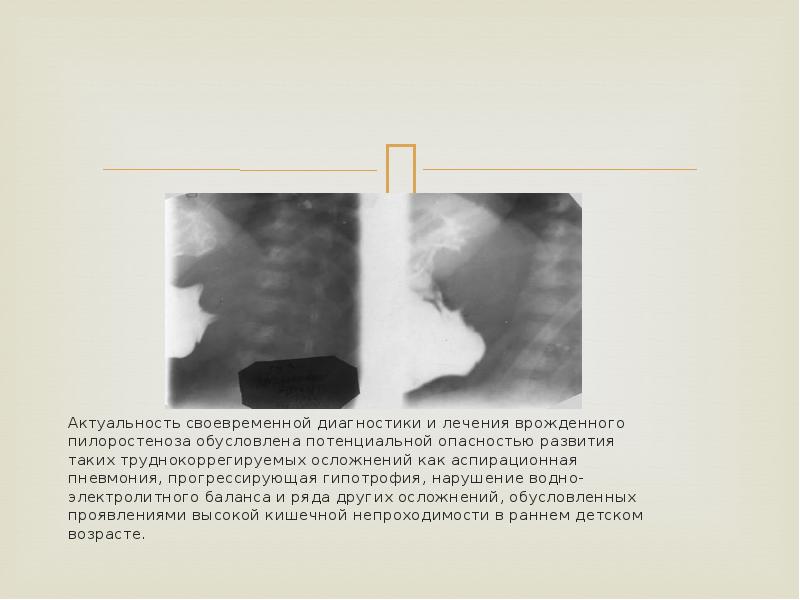 Актуальность своевременной диагностики и лечения врожденного пилоростеноза обусловлена потенциальной опасностью развития Актуальность своевременной диагностики и лечения врожденного пилоростеноза обусловлена потенциальной опасностью развития