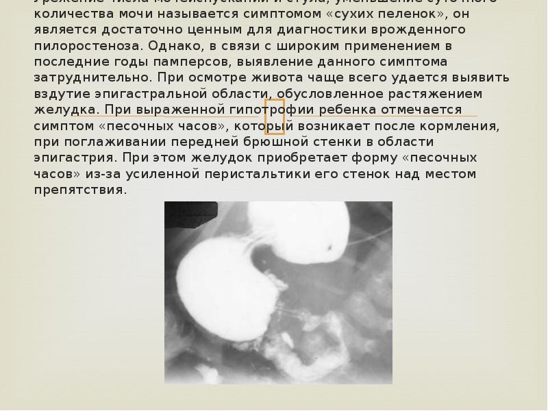 Урежение числа мочеиспусканий и стула, уменьшение суточного количества мочи называется симптомом Урежение числа мочеиспусканий и стула, уменьшение суточного количества мочи называется симптомом