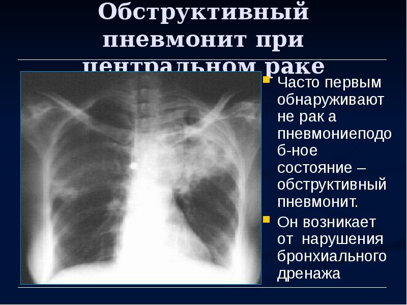 Лучевая диагностика органов дыхания презентация