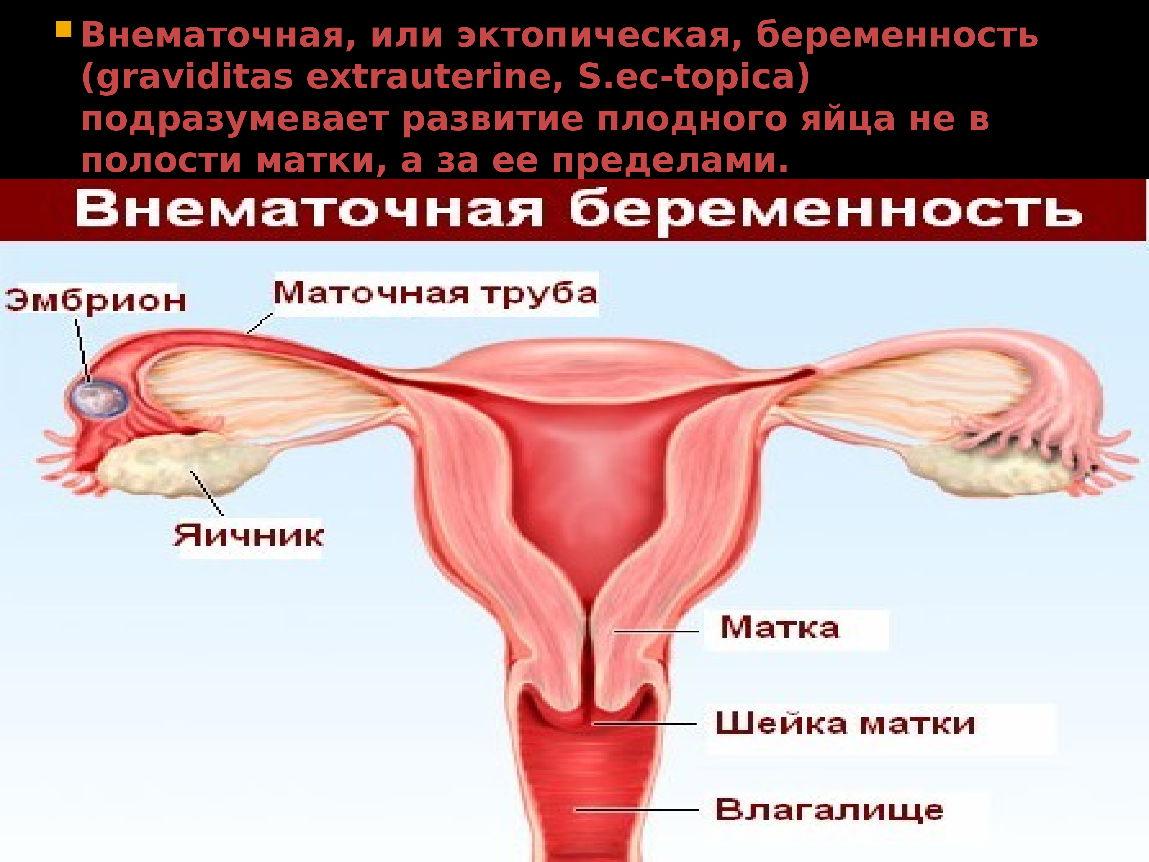увеличивается ли грудь при внематочной беременности фото 7