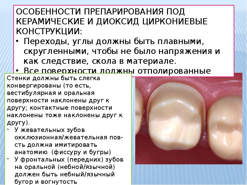 Стоматологическая керамика презентация