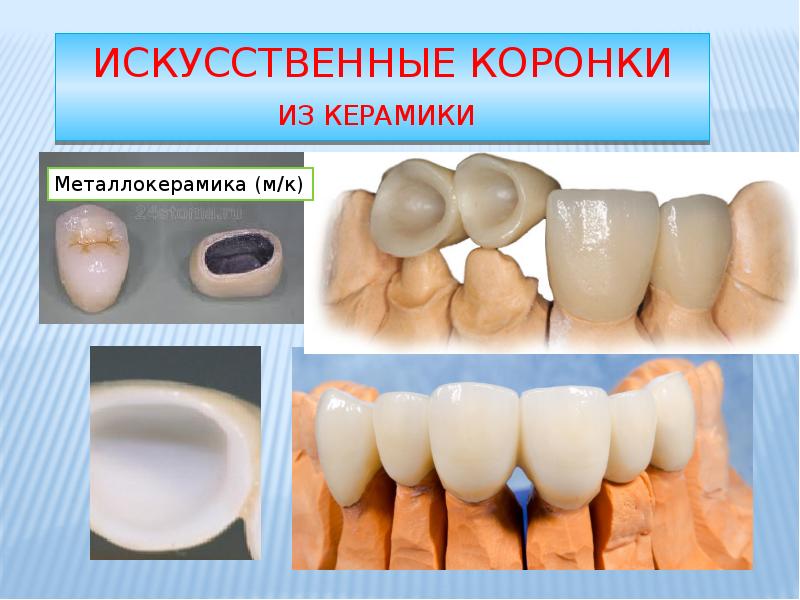 Фарфор ( стоматологическая керамика ) и диоксид циркония