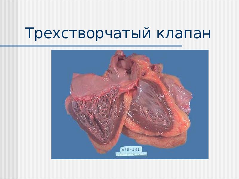 Трехстворчатый клапан Трехстворчатый клапан