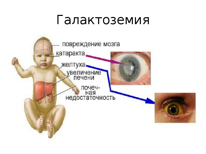 Презентация по желтухам