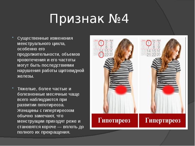 Признакам но они могут быть