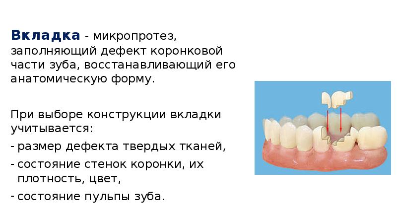 Коронки ортопедическая стоматология презентация