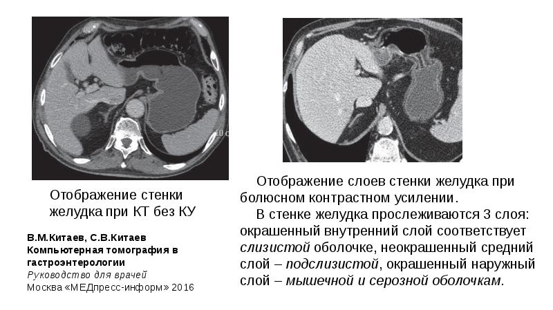 Что является основой изображения органов на кт