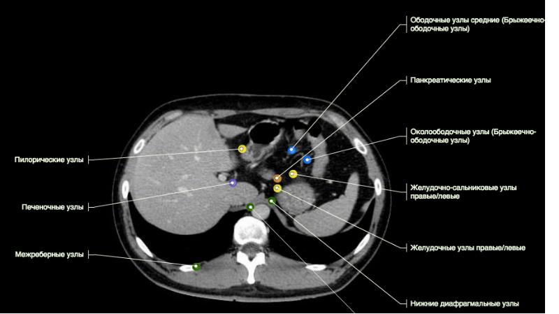Основой изображения органов на кт является