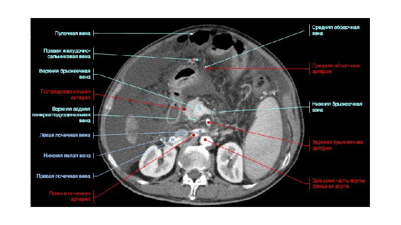Основой изображения органов на кт является