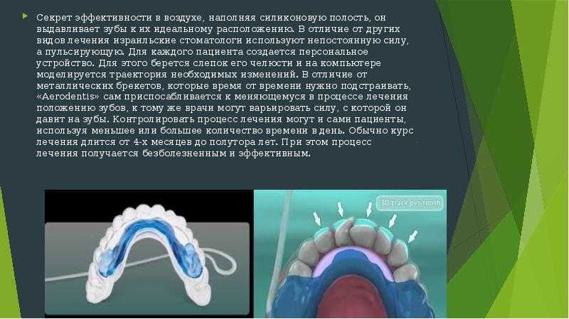 Презентации по ортодонтии