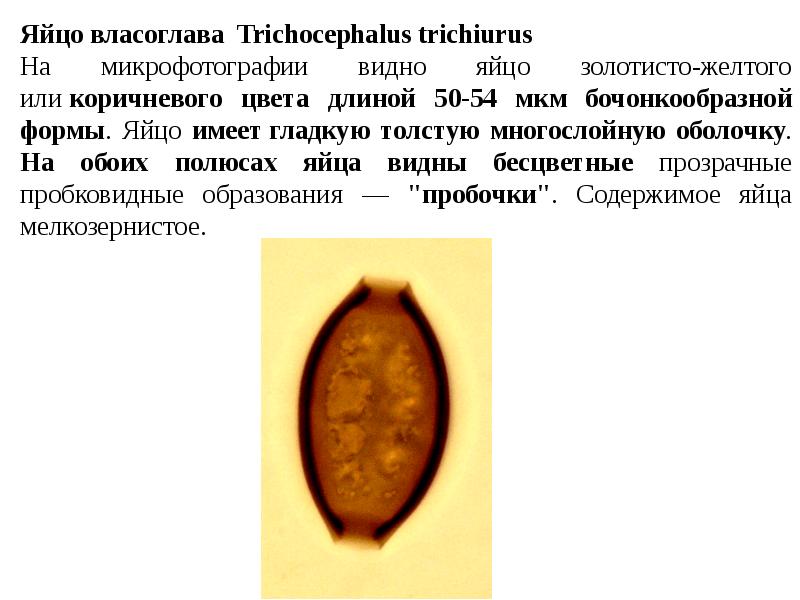 Имей яйца. Trichocephalus Trichiurus яйцо. Яйца власоглава. Яйцо власоглава без микроскопа. Морфология яйца власоглава.