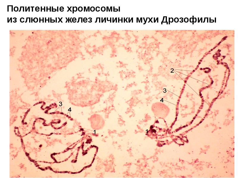 Рисунки микропрепаратов по патанатомии