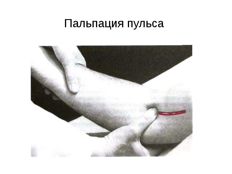 Пальпация пульса