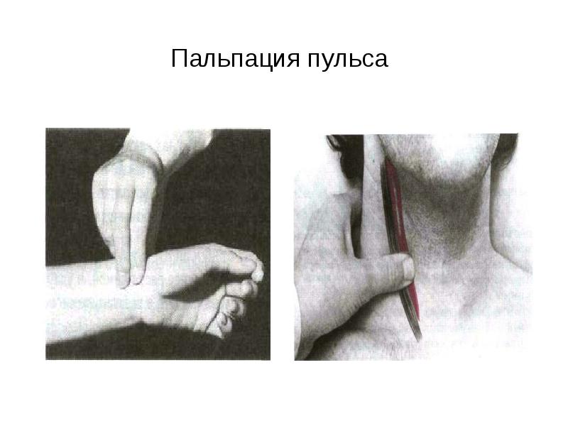 Пальпация пульса