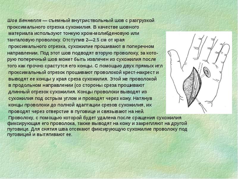 Операции на сухожилиях презентация