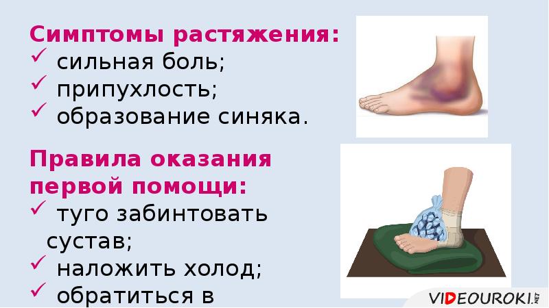 Сколько проходит ушиб. Магнезия при ушибах и травмах. Что прикладывается к месту растяжения или ушиба:. Пиявки при ушибах и растяжениях.