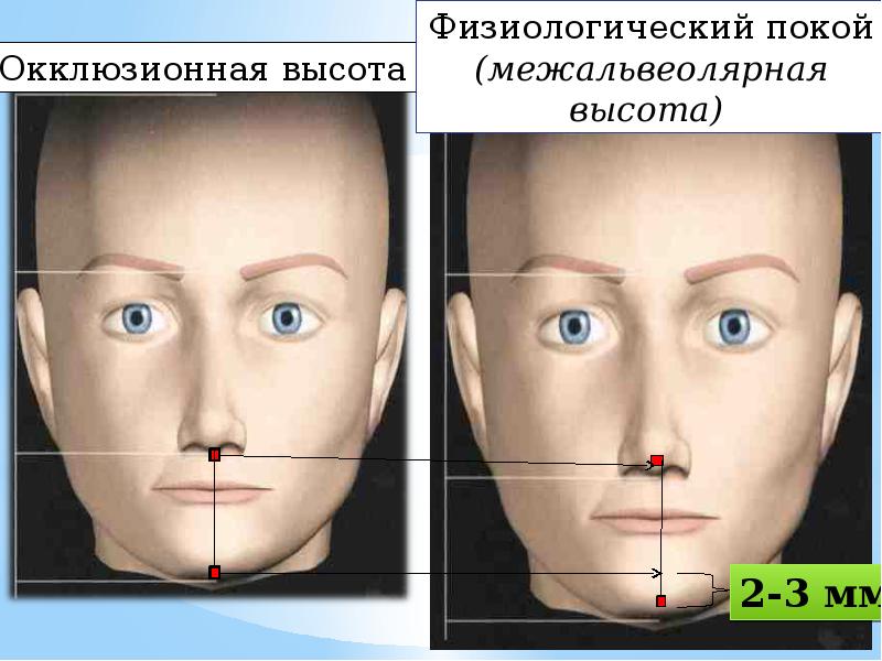 Положение покоя. Межальвеолярная высота. Определение межальвеолярной высоты. Анатомо-функциональный метод определения межальвеолярной высоты. Повышение межальвеолярной высоты.