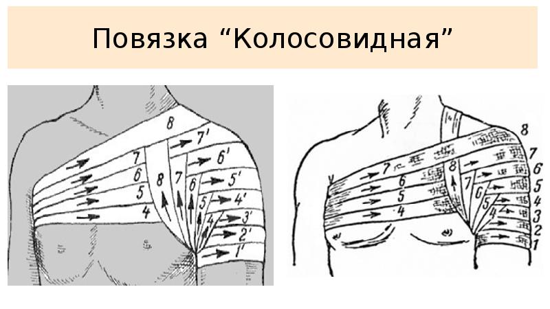 Десмургия презентация қазақша