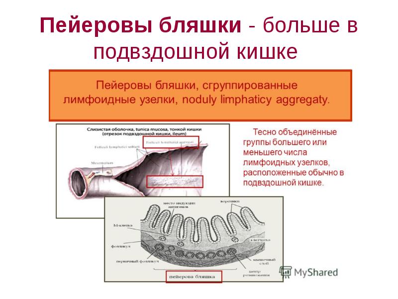 Схема строения пейеровой бляшки