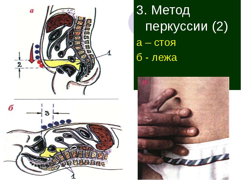 Методы обследования органов пищеварения презентация