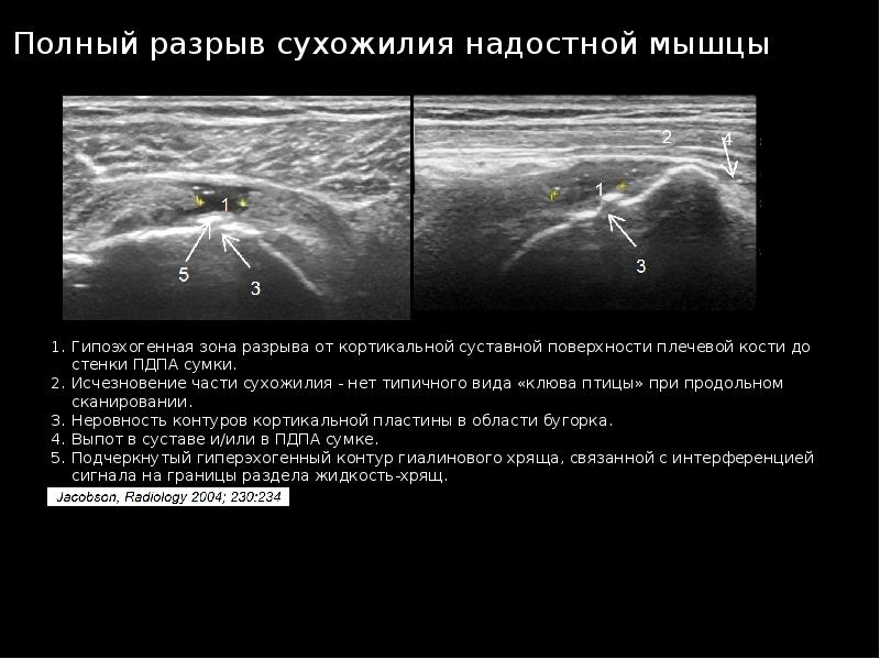 Узи суставов презентация