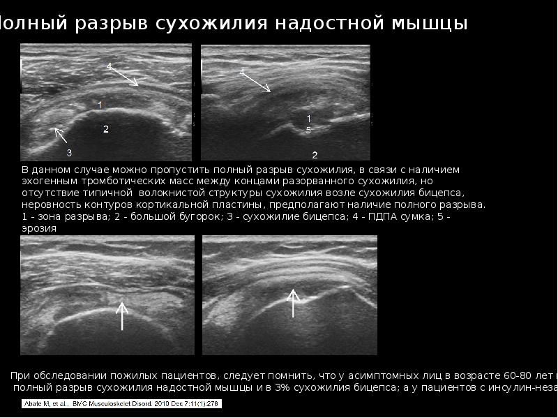 Узи суставов презентация