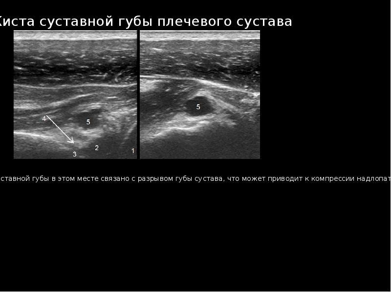 Узи суставов презентация