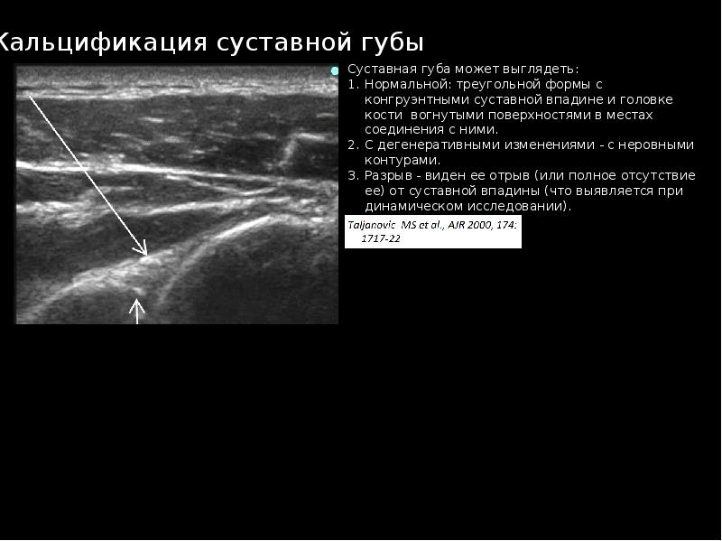 Узи суставов презентация