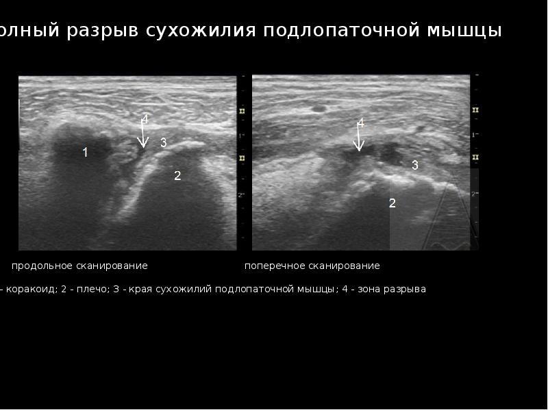 Узи суставов презентация