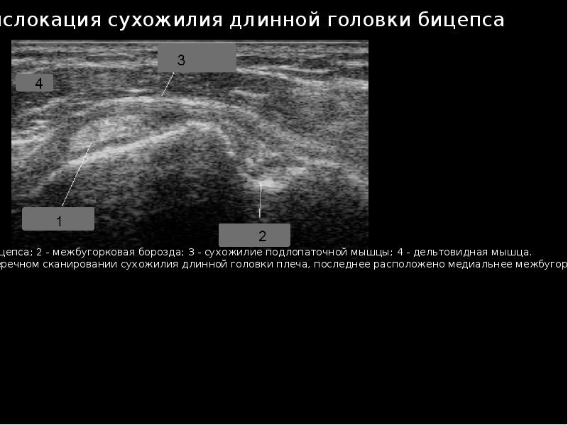 Узи суставов презентация