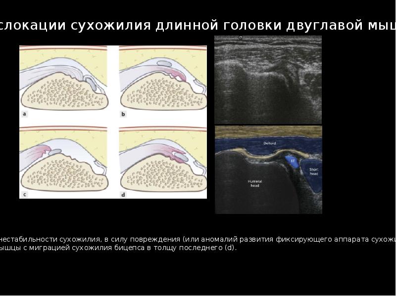 Узи суставов презентация