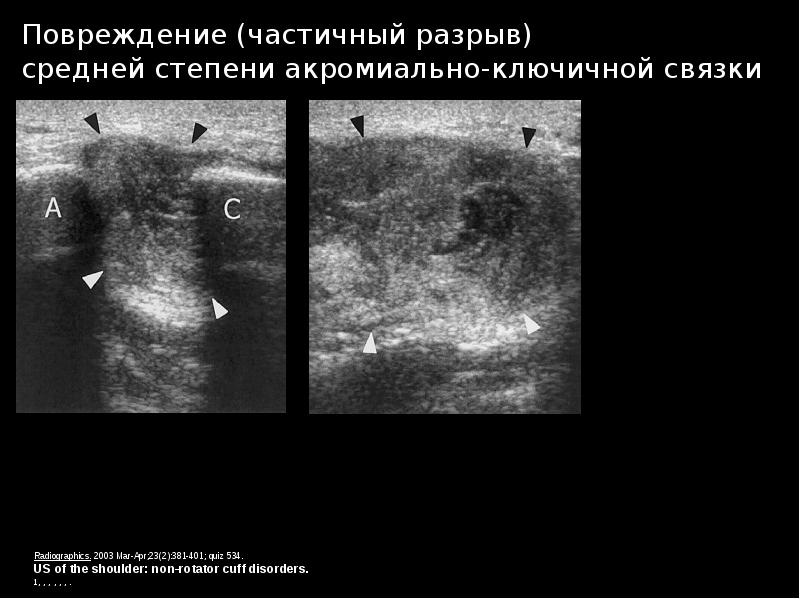 Узи суставов презентация