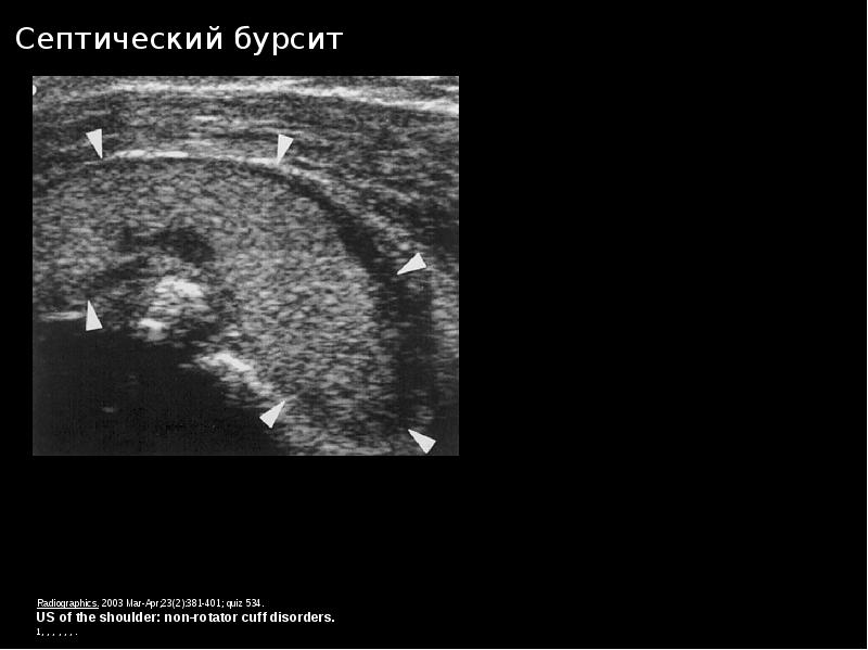 Узи суставов презентация