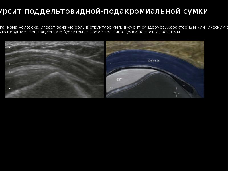 Узи суставов презентация